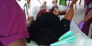 Armed robberies/one victim seriously wounded