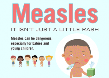 Tourist infected with measles