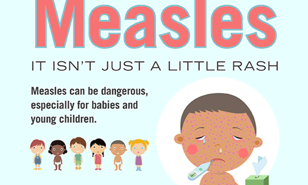 Tourist infected with measles