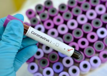 Caribbean now has facility to test for coronavirus