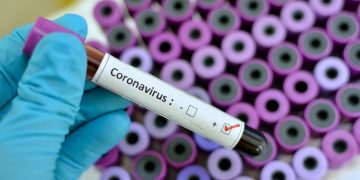 Coronavirus testing equipment arrives in Saint Lucia