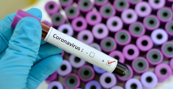 Coronavirus testing equipment arrives in Saint Lucia