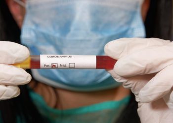 Nearly 10,000 in the Netherlands have coronavirus; Another 93 were reported dead