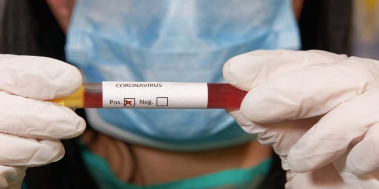 Nearly 10,000 in the Netherlands have coronavirus; Another 93 were reported dead