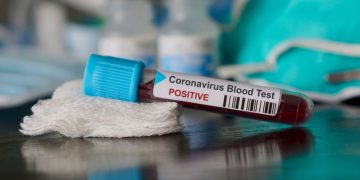 BREAKING NEWS: Three cases of coronavirus confirmed in St. Barthélemy, Saint Martin