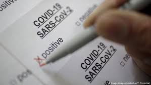 TESTING FOR SARS-COV-2 in COVID-19