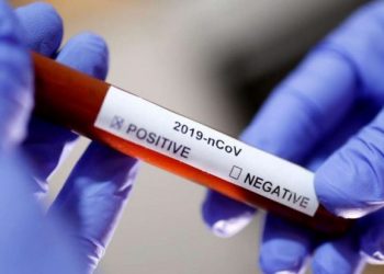 C-19 in Dominican Republic: 20,415 cases, 544 deaths