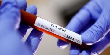 C-19 in Dominican Republic: 20,415 cases, 544 deaths