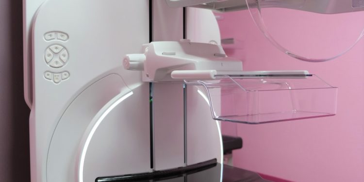 SMMC installs new mammography machine