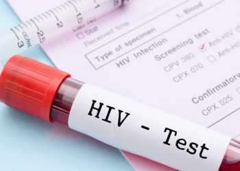 HIV Free Testing available on Saturday