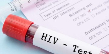 HIV Free Testing available on Saturday