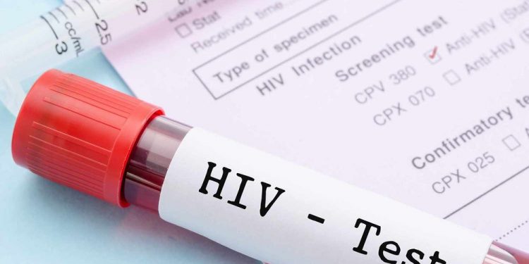 HIV Free Testing available on Saturday