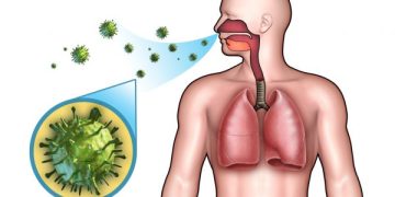 Persons with Respiratory Challenges should take precautionary measures from Saharan dust