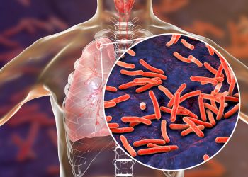 La tuberculosis es prevenible y curable. Evite contagiar la TB a otros