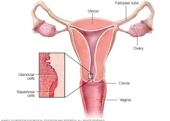La segunda ronda de detección de cáncer de cuello uterino para mujeres de 50 a 60 años comenzará el lunes en St. Eustatius