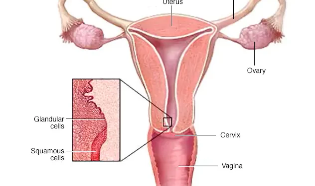 La segunda ronda de detección de cáncer de cuello uterino para mujeres de 50 a 60 años comenzará el lunes en St. Eustatius