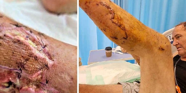 Constructor apenas sobrevive al ser atacado por tres Pit Bulls